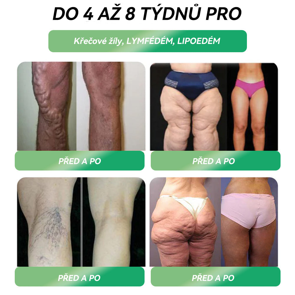 ✅ Doporučilo přes 100 000 lidí |Oficiální obchod | 𝑆𝑇𝐷𝐸𝐼® 👩⚕️👩⚕️ 𝐺𝐿𝑃-1 𝐻𝑢𝑏𝑛𝑢𝑡í Ú𝑠𝑡𝑛í ř𝑒š𝑒𝑛í - Obezita, kardiovaskulární onemocnění, cukrovka, spánková apnoe, problémy s klouby a další