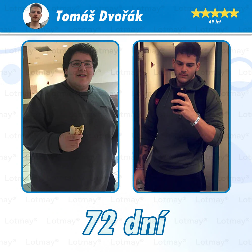 [⚡Oficiální autorizovaný obchod] 𝐿𝑜𝑡𝑚𝑎𝑦® 🔥🔥 𝐺𝐿𝑃-1 𝐻𝑢𝑏𝑛𝑢𝑡í & 𝑧𝑑𝑟𝑎𝑣í 𝑈𝑙𝑡𝑟𝑎𝑘𝑜𝑛𝑐𝑒𝑛𝑡𝑟𝑜𝑣𝑎𝑛é 𝑒𝑠𝑒𝑛𝑐𝑒 𝑣 𝑘𝑎𝑝𝑠𝑙í𝑐ℎ- NAD+ Moringa a jablečný ocet (✅rychlý, dlouhotrvající, řešící cukrovku, obezitu a kardiovaskulární onemocnění)