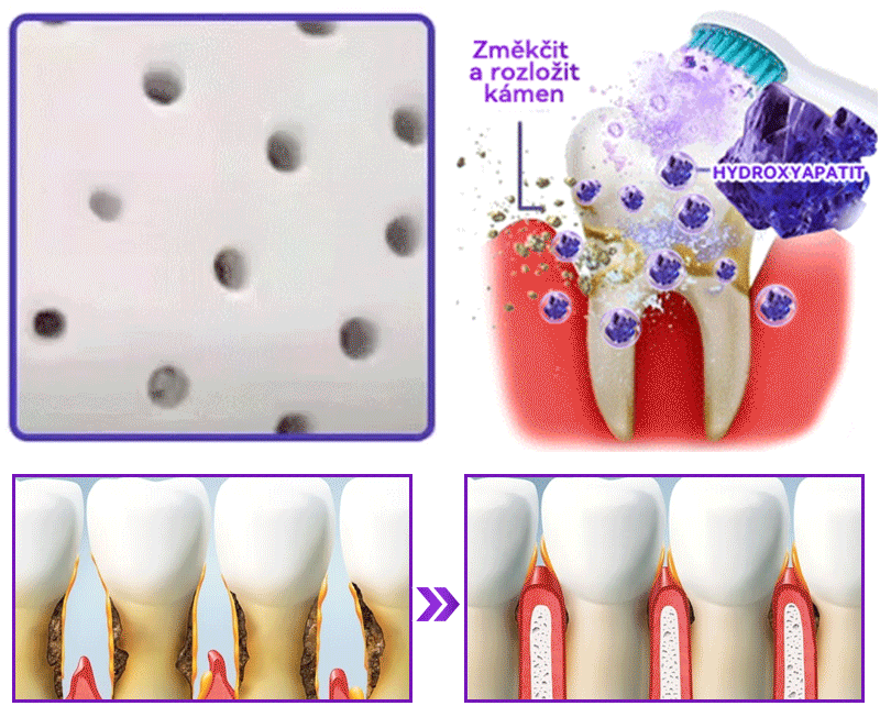 𝑂𝑓𝑖𝑐𝑖á𝑙𝑛í 𝑜𝑏𝑐ℎ𝑜𝑑 | 𝐷𝑜𝑟𝑚𝑜𝑟𝑛𝑎® 🔥𝐻𝑦𝑑𝑟𝑜𝑥𝑦𝑎𝑝𝑎𝑡𝑖𝑡 𝑍𝑢𝑏 𝑂𝑝𝑟𝑎𝑣𝑎 𝑃𝑟áš𝑒𝑘