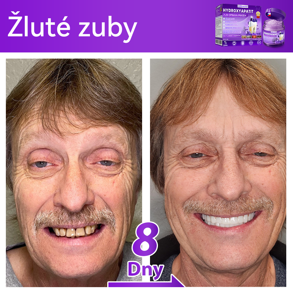 𝑂𝑓𝑖𝑐𝑖á𝑙𝑛í 𝑜𝑏𝑐ℎ𝑜𝑑 | 𝐷𝑜𝑟𝑚𝑜𝑟𝑛𝑎® 🔥𝐻𝑦𝑑𝑟𝑜𝑥𝑦𝑎𝑝𝑎𝑡𝑖𝑡 𝑍𝑢𝑏 𝑂𝑝𝑟𝑎𝑣𝑎 𝑃𝑟áš𝑒𝑘