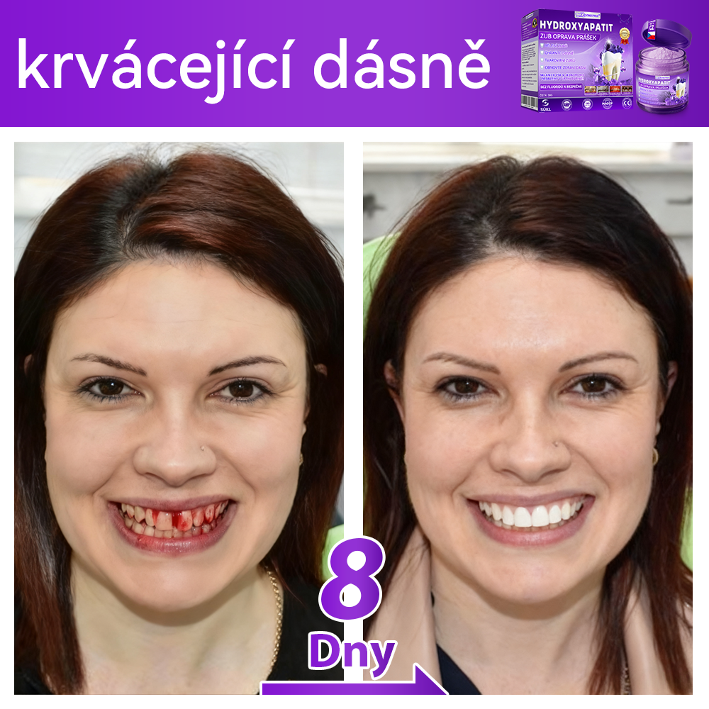 𝑂𝑓𝑖𝑐𝑖á𝑙𝑛í 𝑜𝑏𝑐ℎ𝑜𝑑 | 𝐷𝑜𝑟𝑚𝑜𝑟𝑛𝑎® 🔥𝐻𝑦𝑑𝑟𝑜𝑥𝑦𝑎𝑝𝑎𝑡𝑖𝑡 𝑍𝑢𝑏 𝑂𝑝𝑟𝑎𝑣𝑎 𝑃𝑟áš𝑒𝑘