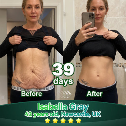 Lotmay® Orální Kapky s Kmenovými Buňkami & Kolagenovými Peptidy 👩‍⚕️ (Pro zpevnění povadlé pleti & redukci tvorby vrásek) 🌿