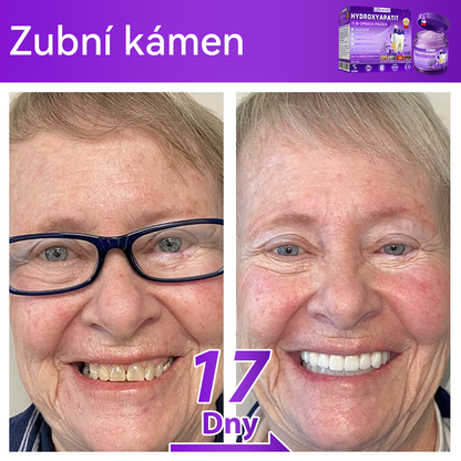 𝑂𝑓𝑖𝑐𝑖á𝑙𝑛í 𝑜𝑏𝑐ℎ𝑜𝑑 | 𝐷𝑜𝑟𝑚𝑜𝑟𝑛𝑎® 🔥𝐻𝑦𝑑𝑟𝑜𝑥𝑦𝑎𝑝𝑎𝑡𝑖𝑡 𝑍𝑢𝑏 𝑂𝑝𝑟𝑎𝑣𝑎 𝑃𝑟áš𝑒𝑘