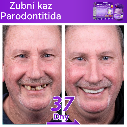 𝑂𝑓𝑖𝑐𝑖á𝑙𝑛í 𝑜𝑏𝑐ℎ𝑜𝑑 | 𝐷𝑜𝑟𝑚𝑜𝑟𝑛𝑎® 🔥𝐻𝑦𝑑𝑟𝑜𝑥𝑦𝑎𝑝𝑎𝑡𝑖𝑡 𝑍𝑢𝑏 𝑂𝑝𝑟𝑎𝑣𝑎 𝑃𝑟áš𝑒𝑘